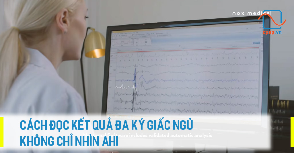 CACH-DOC-KET-QUA-DA-KY-GIAC-NGU-KHONG-CHI-NHIN-AHI