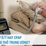 ASV, BIPAP S:T HAY CPAP CHO NGƯNG THỞ TRUNG ƯƠNG