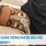 HỘI CHỨNG GIẢM THÔNG KHÍ DO BÉO PHÌ- CPAP HAY BIPAP