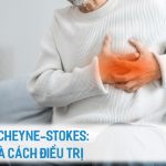 NHỊP THỞ CHEYNE-STOKES- SUY TIM VÀ CÁCH ĐIỀU TRỊ
