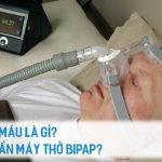 tăng co2 máu là gì và tình trạng tăng co2 máu nào cần máy trợ thở bipap bpap